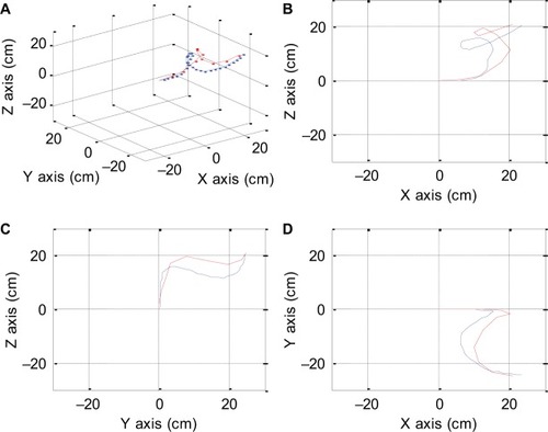 Figure 21 Multiple views of the predicted sigmoid N-spiral test are shown. Isometric view (A), right-side view (B), left-side view (C), top view with right side as X axis (D).