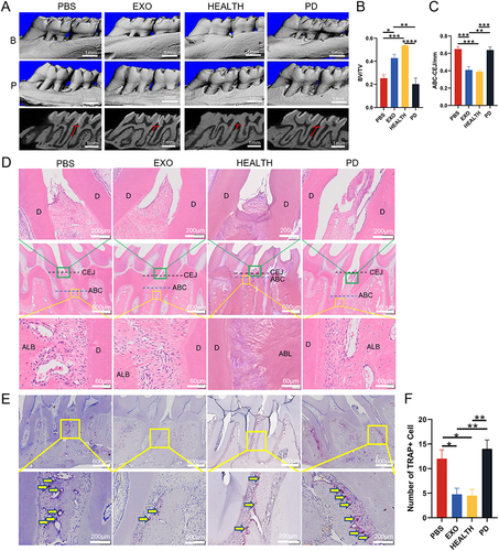 Figure 7 The therapeutic effect of DPSC-EXO on periodontitis in rats. (A) Representative sagittal 3D and 2D views of the maxillary molars from micro-CT scanning. The red line corresponds to the distances of ABC-CEJ. (B) and (C) Measurement of the BV/TV and the distance from the ABC to the CEJ in each group. (D) Representative H&E-stained sections of periodontal tissues harvested from each group at low and high magnifications. The green box shows the details of gingiva, and the yellow box shows the details of alveolar bone crest. (E) The degree of osteoclast infiltration in representative TRAP-stained sections of periodontal tissues. (F) Quantitative analysis of osteoclast number between the first and second molars. The yellow arrows show that osteoclasts are stained red. (B) Buccal side; (P) Palatal side; PD: Periodontitis; BV/TV: Bone tissue volume/tissue volume (%); ABC-CEJ: Alveolar bone crest and the cementoenamel junction; Results are the mean ± s.d. (*p < 0.05, **p < 0.01, ***p<0.001, ****p<0.0001, n = 4).