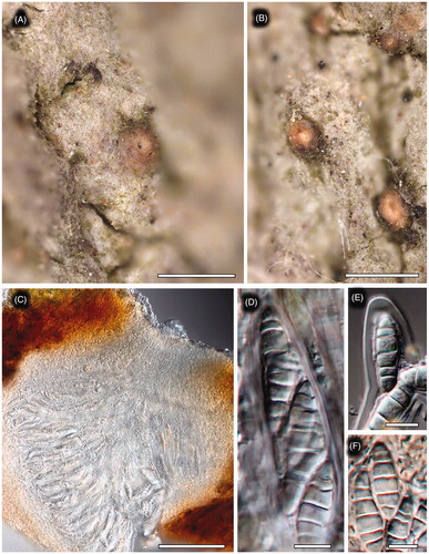 Figure 4. Phylloblastia gyeongsangbukensis (KoLRI 39225 HOLOTYPUS), Korea, Ullung-do, Gyeongsangbuk-do, Ullung-gun, Ullung-eup, Sadong-ri, N37°29′20,65′′E130°53′20,59′′, 479 m, on bark, 8. 7. 2016, col. J. Halda. Photo J. P. Halda 2019; (A, B) thallus with ascomata; (C) vertical section of an ascoma; (D) ascus with ascospores; (E, F) ascospores, mounted in water; Scales: A, B – 500 μm, C – 100 μm, D–F – 10 μm.