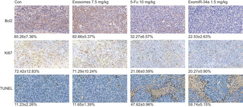 Figure 6 Immunohistochemical (IHC) and TUNEL assay of tumors in vivo. Tumor tissues excised from Panc28 tumor-bearing mice were analyzed using IHC analysis and TUNEL assay as described in the Materials and Methods section. The level of Ki67 and Bcl-2 protein expression in the tumor tissues was determined using IHC staining approach. The apoptosis rate of tumor tissues was detected using a TUNEL assay. Data are shown as mean ± SD. n≥3.