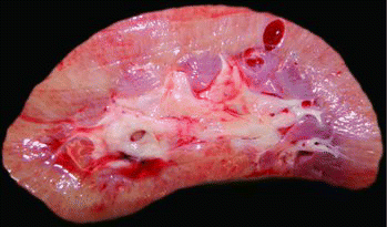 Figure 2. Postmortem gross image of the kidney. Note the variation in cortical thickness, indistinct corticomedullary junction, and cystic dilations within the cortex.