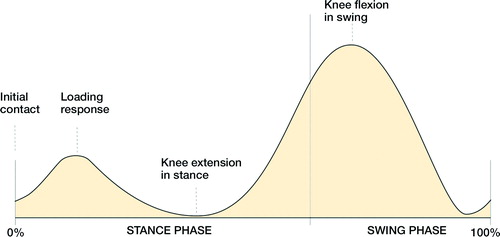 Figure 1. The 4 knee-flexion and extension variables selected for the analysis (stance and swing phase in percentage of the gait cycle on the X-axis). 1: Knee flexion at initial contact (0% of the gait cycle) important for step length, which can be limited by hamstring spasticity and/or short hamstring muscles; 2: maximum knee flexion at loading response (0–40% of the gait cycle) manages force absorption; 3: minimum knee flexion in stance (25–75% of the gait cycle) describes degree of crouch; 4: and maximum knee flexion in swing (50–100% of the gait cycle) contributes to foot clearance.