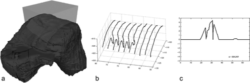 Figure 7. Two-dimensional surface scanning within a region of interest and derivation of the arthroplasty score.