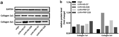 Figure 5. Protein expression changes of Collagen 1a1 and Collagen 3a1 (Western blotting) a. Western analysis of Collagen 1a1 and Collagen 3a1 at different time points of NS and PRP group in rat skin. b. Quantitative protein levels of Collagen 1a1 and Collagen 3a1 expression in the two group at different time points