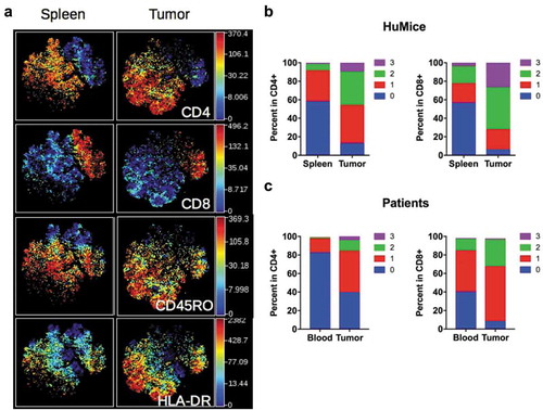 Figure 3. Activation status of Tumor-infiltrating T cells of HuMice and breast cancer patients. (a) hCD45+CD3+ from HuMice were gated in Cytobank and a viSNE plot was generated according to CD4, CD8, CD45RO, HLA-DR, PD-1, CD25, Ki-67 and GrzB expression using equal sampling with 8574 events in the spleen and tumor. (b) Mean frequencies of cells expressing 0, 1, any combination of two or all three activation/memory markers are shown in the indicated tissue. Activation/memory markers used for boolean analysis were CD25, HLA-DR, and PD-1 for CD4+ T cells and HLA-DR, Grz-B, and CD45RO for CD8+ T cells. Results are from one experiment out of three. (c) Same analysis for T cells from breast cancer patients. Results are mean frequencies in nine breast cancer patients in nine independent experiments in the blood and the tumor determined by flow cytometry. The activation markers used for boolean analysis were HLA-DR, ICOS, and PD-1 for CD4+ T cells and CD45RA, Grz-B and HLA-DR for CD8+ T cells (negativity for CD45RA was considered as an activated/memory phenotype).