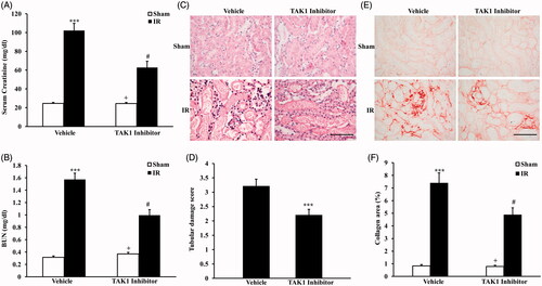 Figure 1. Inhibition of TAK1 alleviates ischemia-induced renal fibrosis in vivo. (A) Effect of TAK1 inhibition on serum creatinine in vehicle group and TAK1 inhibitor group mice at 24 h after IR or sham treatment. ***p < .001 versus sham vehicle; +p < .05 versus TAK1 inhibitor IR; #p < .05 versus vehicle IR. n = 6 in each group. (B) Effect of TAK1 inhibition on serum urea nitrogen in Vehicle group and TAK1 inhibitor group mice at 24 h after IR or sham treatment. ***p < .001 versus sham vehicle; +p < .05 versus TAK1 inhibitor IR; #p < .05 versus vehicle IR. n = 6 in each group. (C) HE staining for kidney sections of vehicle group and TAK1 inhibitor group mice at 24 h after IR or sham treatment (original magnification: ×400, Scale bar: 50 μm). (D) Quantitative assessment of tubular damage in vehicle and TAK1 inhibitor group mice at 24 h after IR treatment. ***p < .001 versus vehicle IR. n = 6 in each group. (E) Representative photomicrographs of kidney sections stained with Sirius red for assessment of total collagen deposition in vehicle group and TAK1 inhibitor group mice at 14 days after IR or sham treatment. Scale bar: 50 μm. (F) Quantitative analysis of interstitial collagen content in kidneys of vehicle group and TAK1 inhibitor group mice at 14 days after IR or sham treatment. ***p < .001 versus sham vehicle; +p < .05 versus TAK1 inhibitor IR; #p < .05 versus vehicle IR. n = 6 in each group.