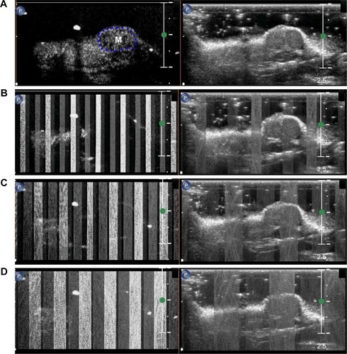 Figure 3 Destruction of NBs in tumor xenografts at different ultrasonic power intensities.Notes: (A) Imaging of NBs in tumor xenografts under conventional contrast-enhanced grayscale ultrasound. (B–D) Destruction and waveform conditions of NBs in tumor-xenograft regions under three intensities of ultrasonic power: 1, 1.75, 2.5 W/cm2, respectively.Abbreviations: NBs, nanobubbles; M, mass.