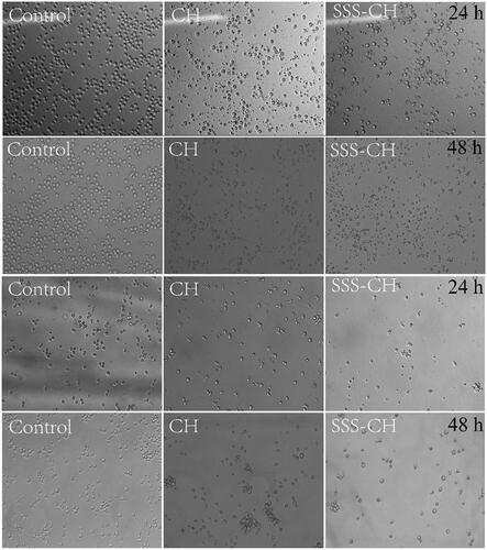 Figure 6. Cell morphologies of CEM (upper) and Ramous (lower) cells incubated with 100 µg/mL samples for 24 h and 48 h. Magnification: ×100.