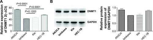 Figure 1 Differential DNMT1 expression in endometrial cancer cell lines.