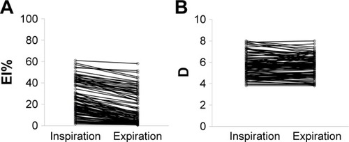 Figure 2 Effects of inspiration and expiration on (A) EI%s and (B) Ds.