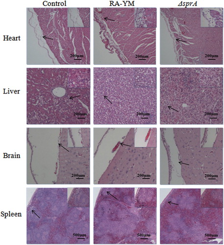 Figure 5. Photomicrograph of histopathological study on tissues from ducklings infected with wild-type strain RA-YM or mutant strain ΔsprA at 24 h post-challenge (HE, × 400). The arrows in the figure indicate the normal (control group) and lesion (RA-YM or ΔsprA infected group) regions of the organs at 24 h post-challenge. Compared with the control group (the left column), there were obvious histopathological changes in the wild-type RA-YM infected group (the middle column): in heart, the visceral pericardium became thickened due to fibrin exudation and inflammatory cell infiltration; in liver, severe fatty degeneration was found, and white pulp lymphocytes hyperplasia occurred in the spleen; no obvious pathological change was found in brain tissue. The histopathological change in the mutant strain ΔsprA infected group (the right column) was slight, thus the tissues from this group looked similar to those of the control group.