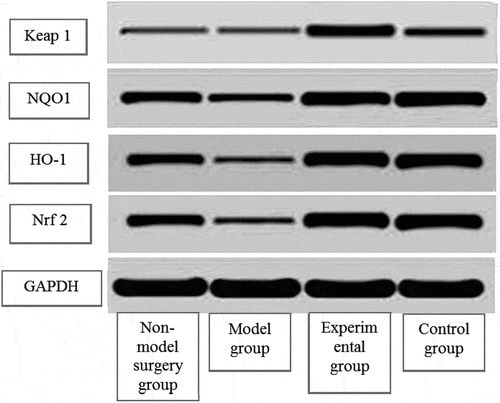 Figure 8. The detection results of protein expression in each group of rats.