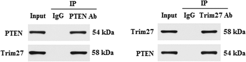 Figure 6. Trim 27 interacted with PTEN in NRCMs. Co-IP assay was performed to examine the interaction between Trim27 and PTEN in NRCMs.