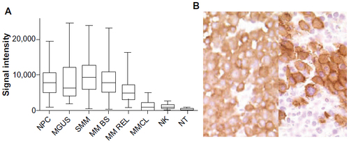 Figure 1 CS1 expression quantified by gene expression (A), and immunohistochemistry (B).