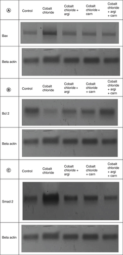 Figure 7. (A–C) Representative immunoblots (Western blot analysis) of cardiac Bax, Bcl 2, and Smad-2 in control and different treated groups.