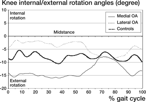 Figure 12. Mean value of knee or relative tibial internal/ external rotation angles related to a standardized gait cycle in women with medial or lateral OA and in the controls. Rotation of tibia vs. femur. See also legend to Figure 1.