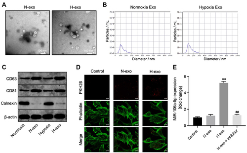 Figure 2 MiR-106a-5p could be transferred from hypoxic glioma cells to glioma cells via exosomes. (A) Exosomes were isolated from hypoxic or normoxia glioma cells (H-exo or N-exo), and were observed by TEM. (B) NTA was applied for exosome identification. (C) The expressions of CD81, CD63 and calnexin in normoxia cells, hypoxia cells, H-exo or N-exo were examined by Western blot. (D) The exosomes absorbed by glioma cells were observed by fluorescence staining. (E) Glioma cells were treated with N-exo, H-exo or H-exo + miR-106a-5p inhibitor. The level of miR-106a-5p in glioma cells was assessed by RT-qPCR. **P< 0.01 compared to control. ##P< 0.01 compared to hypoxia Exo.