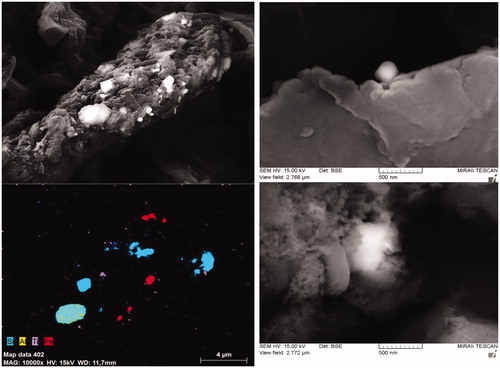 Figure 8. SEM characterization of detected particles detected in a dried liver sample. In addition to the elements indicated in the picture, oxygen was also measured but not shown in the picture. The SEM image on the left shows TiO2 and SiO2 particles as well as aluminum silicate and iron particles. The images on the right show a TiO2 particle (top) and a SiO2 particle (bottom).