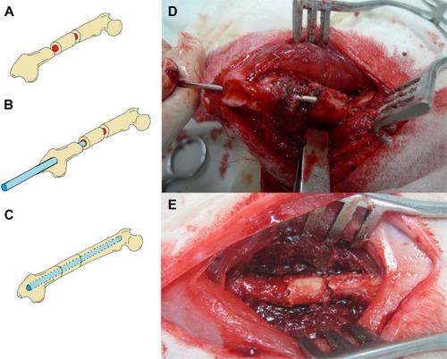 Figure 3 A rabbit in group A that received intramedullary K-wire fixation only.Notes: (A) Illustration shows a segmental fracture on the femoral shaft. (B) Illustration shows an intramedullary K-wire fixation. (C) Illustration demonstrates the final fixation configuration. (D) Photography shows the procedure of the K-wire fixation. (E) Photography demonstrates an acceptable bone alignment after the K-wire fixation.Abbreviation: K-wire, Kirschner-wire.