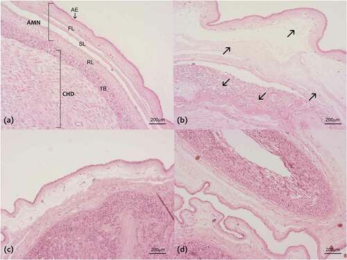 Figure 7. Histological characteristics of fetal membranes after the treatments: (a) Control condition, (b) LPS treatment (500 ng/ml), (c) PRL treatment alone (4000 ng/ml) and (d) co-treatment with LPS and PRL. It is noted the amnion (AMN) composed of the amniotic epithelium (AE) and the fiber layer (FL), sponge layer (SL) and reticular layer (RL) which permit the structural continuity between choriodecidua (CHD) and AMN. After the LPS treatment, it is observed as the fiber network becomes lax (arrows), causing the alteration in the FL, SL, RL and in the ECM that surrounds the trophoblast (TB), which eventually cause loss of the structural integrity of the chorioamniotic membranes. Original magnification 40×.