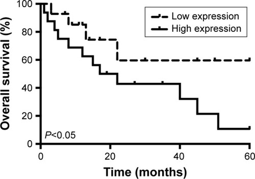 Figure 2 Kaplan–Meier’s survival analysis in patients with osteosarcoma. The high expression of PCAT1 was positively correlated with shorter overall survival rate in patients with osteosarcoma.