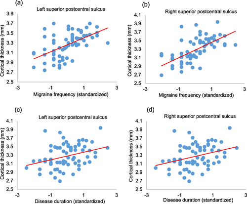 Figure 2 Scatter plot graphs of correlation analysis between migraine frequency and cortical thickness in the left (a) and right (b) superior postcentral sulcus, as well as between disease duration and cortical thickness in the left (c) and right (d) superior postcentral sulcus in the combined migraine group (P < 0.001).