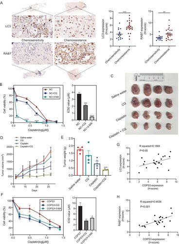Figure 4. COPS3-induced autophagy mediates cisplatin resistance. (A) Immunohistochemical images of LC3 and RAB7 expression in human osteosarcoma tissues with different responses to preoperative chemotherapy (tumor necrosis ≥90%: chemosensitivity; tumor necrosis <90%: chemoresistance). Data are presented as mean ± SEM. **p < 0.01, *** p < 0.001. (B) Cell viability was measured using CCK-8 assay in 143B cells treated with cisplatin, cisplatin + CQ (10 μM), or cisplatin + 3-MA (5 mM) for 24 h. IC50 values of the different groups are statistically analyzed. Data are presented as mean ± SEM of triplicates. *p < 0.05, **p < 0.01, *** p < 0.001, **** p < 0.0001. (C-E) BALB/c nude mice (n = 4 mice per group) were injected with 143B cells and treated with saline water, CQ, cisplatin, or cisplatin + CQ. (C) Tumors excised from the different groups are shown. (D) Tumor growth curves of the different treatment groups. (E) Weight of the excised tumors in each group. Data are presented as mean ± SEM. *p < 0.05, **p < 0.01, *** p < 0.001. (F) Cell viability was measured using CCK-8 assay in Saos-2 cells transfected with COPS3 overexpression vector and treated with cisplatin, cisplatin + CQ (10 μM), or cisplatin + 3-MA (5 mM) for 24 h. The IC50 values of the different groups are statistically analyzed. Data are presented as mean ± SEM of triplicates. *p < 0.05, **p < 0.01. (G and H) The correlations between the levels of LC3, RAB7, and COPS3 expression in 22 chemoresistant OS samples are shown.