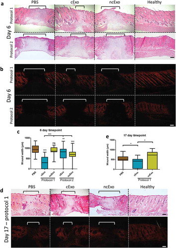 Figure 8. cExo stimulate wound healing. Two protocols were tried. In protocol 1, 7.6 µg exosomes were applied over the first 2 days. Protocol 2 involved applying 12.5 µg exosomes on day 0 only. (a) For protocol 1, H&E staining revealed a reduced wound size (brackets) and a largely restored histological architecture surrounding the wound area in the cExo group. In contrast, ncExo appears similar to the PBS group. Protocol 2 was considerably less effective with similar histopathology between the groups. (b) Polarized visualization of Picrosirius staining clearly shows the wound area (brackets) with less signal due to minimal collagen content. (c) Quantification of the wound sizes revealed a considerable decrease of wound size using cExo and protocol 1, significant from all other groups. (d) Protocol 1 on a 17-day time point revealed similar results, with a reduced wound size by cExo only, confirmed by blinded quantification (e). Scale bars = 200 µm.