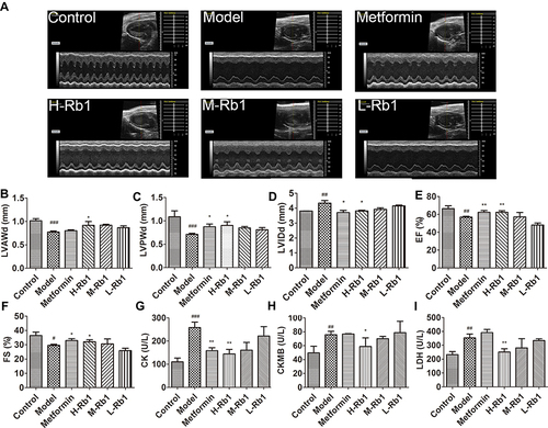 Figure 3 Ginsenoside Rb1 ameliorated cardiac dysfunction in diabetic mice. (A) Representative images of echocardiography from mice after 12 weeks of treatment. Statistical analyses of (B) LVAWd; (C) LVPWd; (D) LVIDd; (E) EF and (F) FS in indicated groups. Serum (G) CK; (H) CK-MB and (I) LDH in indicated groups. Data are expressed as the mean ± SEM (n = 3–6). *p<0.05 or **p<0.01 vs model group; #p<0.05 or ##p<0.01 or ###p<0.001 vs the control.