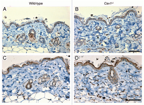 Figure 7 Autophagy/mitophagy in stromal cells from the dermis of wild-type and Cav-1-/- mice. Paraffin-embedded sections from the skin were stained with a LC3 antibody, to evaluate the degree of autophagy in stromal cells in the dermis of wild-type (A) and Cav-1-/- mice (B). Note that an increased number of stromal cells are positive for LC3 in the dermis of Cav-1-/- mice, in comparison to wild-type mice. The skin sections of these two groups were also stained with BNIP3L, a mitophagy marker. A marked increased in the number of dermal stromal cells that are positive for BNIP3L was observed in Cav-1-/- mice (D), in comparison with wild-type mice (C).