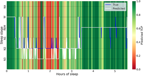 Figure 2 Combined output of the predicted hypnogram (in white) and the associated confidence. TCP-scores (in the background), supplemented with the physician-scored hypnogram (in blue).