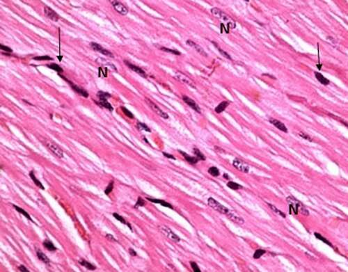 Figure 1. A photomicrograph of the control rat left ventricle (group I) showing, branching striated cardiac muscle fibers running in different directions with single central oval vesicular nuclei (n) and narrow spaces in between. Notice dark nuclei of connective tissue cells (↑). (H&E stain, X 100).