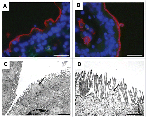 Figure 8. Deterioration of the brush border near a zone of denudation induced by 2 mM LC. A, B: Immunofluorescent images of sections labeled for the apical membrane marker aminopeptidase N as in Fig. 5, showing buckling (A) and blebbing (B) of the brush border. C, D: Electron micrographs showing microvillus deterioration and formation of blebs by surplus membrane (arrows). The images shown of each situation are representative of at least 5 images. Bars: 20 µm (A, B); 2 µm (C); 1 µm (D).
