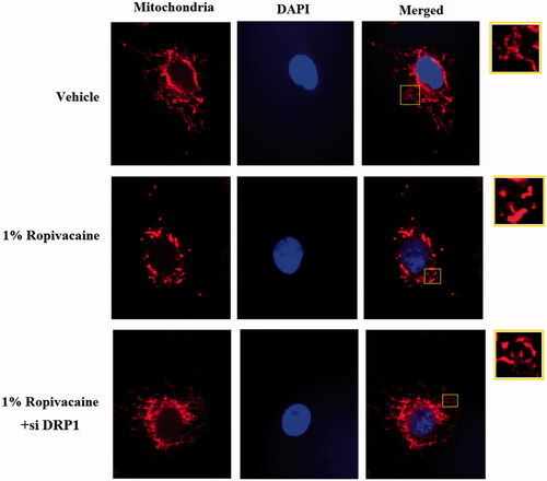 Figure 5. Silencing of DRP1 ameliorated ropivacaine-induced mitochondrial fission. Human SH-SY5Y neuronal cells were infected with DRP1 siRNA Ad-virus for 12 h, followed by treatment with 0.5% and 1% ropivacaine for 72 h. Mitochondrial morphology was measured by MitoTracker red staining.