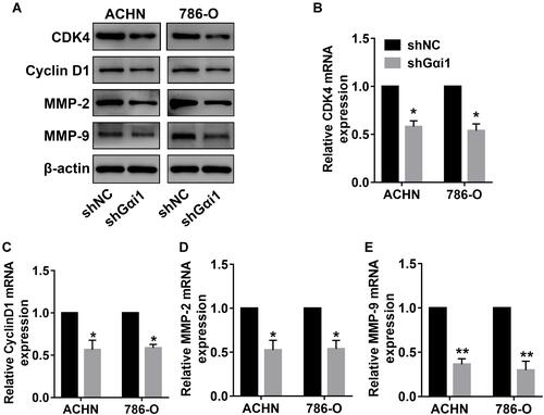 Figure 4 Gαi1 knockdown inhibited the expression of CDK4, cyclin D1, MMP-2 and MMP-9 in RCC cells. (A) Western blot analysis of CDK4, cyclin D1, MMP-2 and MMP-9 protein expression in 786-O and ACHN cells with Gαi1 knockdown. (B–E) The mRNA expression of CDK4, yclin D1, MMP-2 and MMP-9 was detected by qRT-PCR in 786-O cells of shNC and shGαi1 groups. Results were presented as mean ± SD. *P<0.05, **P<0.01.