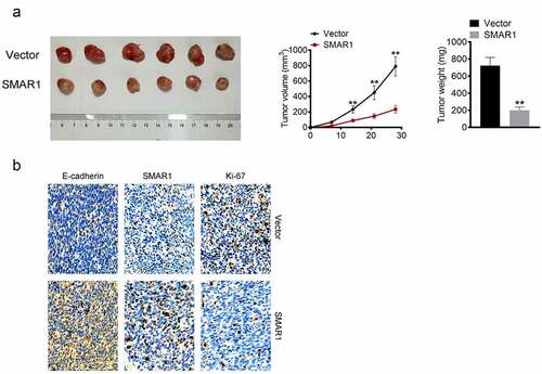 Figure 5. SMAR1 inhibits the growth of BCa cells in vivo. (a) the volume and weight of xenografted tumor tissues. (b) Proteins expressions of Ki-67, SMAR1, and E-cadherin in xenografted tumor tissues by IHC. ** P <0.01 vs. Vector group.