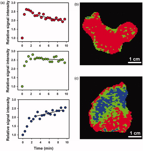 Figure 1. Relative signal intensity versus time after the administration of contrast agent for single tumor voxels, illustrating the three main types of late-phase SITC and the curve fits (a). Late-phase SITC images of a homogeneous tumor with high TFDS (b) and a heterogeneous tumor with a high TFIS (c). Voxels showing decreasing signal intensity are depicted in red, voxels showing increasing signal intensity are depicted in blue, and voxels having SITCs with slopes that were not significantly different from zero are depicted in green.