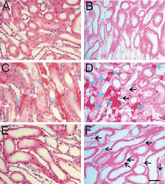 Figure 2. Light micrographs of inner cortex-outer medulla. Kidneys were perfused with trypan blue, as described in Figure 1. A and B are kidneys before ischemia. C and D are kidneys after 90 min of warm ischemia. E and F are kidneys after 48 h of cold storage in UW solution. A, C and E were stained with H&E. B, D and F were stained with eosin only to visualize trypan blue-stained nuclei as indicators of loss of cell viability. Blue arrows identify peritubular erythrocyte trapping. White arrows identify luminal debris or casts. Black arrows identify trypan blue-labeled nonviable cells. Scale bar is 50 µm. (See color insert at end of issue.)