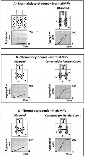 Figure 2. Effects of platelet count and mean platelet volume (MPV) on platelet aggregation measured by Multiplate™. (a): Electric conductance (left-right double arrow) is high between two electrodes immersed in a sample of resting platelets (discs) [left]. Upon ADP stimulation, platelets are activated (spiny spheres) and adhere to electrodes and to each other (aggregation), increasing the impedance, which is recorded as tracings of increasing aggregation units, and expressed as area under the curve (AUC) [right]. (b) and (c) [left]: ADP-induced platelet aggregation in samples with thrombocytopenia and normal (b) or high MPV (c); (b) and (c) [right]: ADP-induced platelet aggregation in the same thrombocytopenic samples as in [left], after correction for platelet count by expressing results as AUC/platelet count ratio: this procedure is equivalent to extrapolating the results obtained in the thrombocytopenic samples to those that would have been obtained in the same samples by addition of “virtual platelets” (white spiny spheres) with the same MPV, to reach normal platelet count [right]. Aggregation tracings in the figure are not based on real data and should be considered illustrative.
