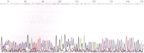 Figure 2. Partial sequencing diagram of A/G mutation in the 66 locus of MTRR gene.