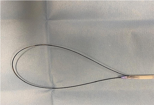 Figure 2 Photograph of the Urethrotech catheterisation device showing the tip of the guidewire entering the main drainage channel of the three-way Foley catheter.
