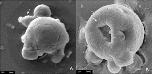Figure 6 Scanning electron micrography of macrophage (P388-D1 cells) exposed to dye loaded nanoparticle. (A) control nanoparticle engulfed by the cell (without irradiation); (B) nanoparticles with BChl-a 30 J/cm2 showing a burst (→) of nanoparticle inside the cell. Scale barr 1 μ m.