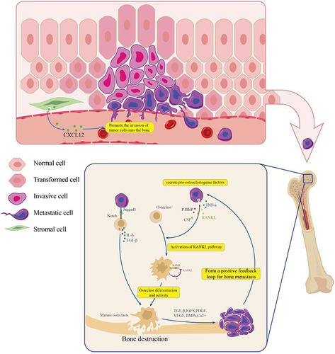 Figure 2 Vicious cycle in the bone microenvironment of breast cancer bone metastases.