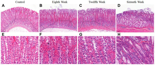 Figure 2 Histopathological changes of gastric mucosa following administration of N‐methyl‐Nʹ‐nitro‐N‐nitrosoguanidine (MNNG) for 8, 12 and 16 weeks. (A and E) Histopathological changes of gastric mucosa in the control group (H&E staining, 10×, 40×). (B and F) Histopathological changes of gastric mucosa in the 8th week (H&E staining, 10×, 40×). (C and G) Histopathological changes of gastric mucosa in the 12th week (H&E staining, 10×, 40×). (D and H) Histopathological changes of gastric mucosa in the 16th week (H&E staining, 10×, 40×).