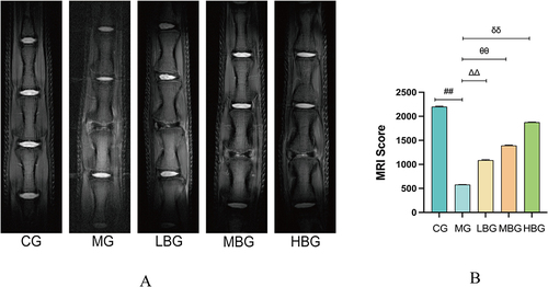 Figure 1 BSHXF improves the morphology and structure of intervertebral disc tissue. (A and B) T2-weighted MRI was used to detect intervertebral disc tissue. Data are means ± SD. (##P < 0.01; ∆∆P < 0.01; θθP< 0.01; δδP< 0.01).