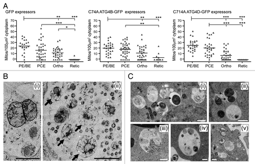 Figure 7. Mitochondrial clearance in human erythroid cells expressing cysteine mutants of ATG4. (A) Morphometric analysis of mitochondrial number in the cytoplasm of differentiating erythroblasts expressing GFP, GFP-ATG4BC74A or GFP-ATG4DC144A. Bars represent means. Tukey’s multiple comparison test: *p ≤ 0.05; **p ≤ 0.01; ***p ≤ 0.001. (B) Examples electron micrographs of type II amphisomes, showing intact mitochondria (i) and distorted, partially degraded mitochondria (ii, arrows). Scale bars: 500 nm. (C) Examples of vacuolar compartments in control erythroid cells treated with bafilomycin A1 (6 h). Mitochondria can be seen within autophagosomes and amphisomes (i and ii, arrows), while enlarged structures similar to the type II amphisomes that we have described are also prominent features (iii–v). Scale bars: 500 nm.