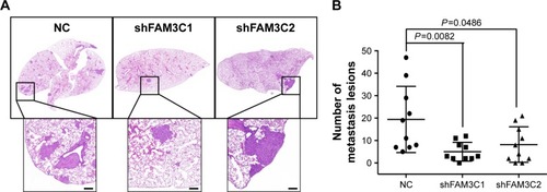 Figure 6 Knockdown of FAM3C reduced gastric cancer metastatic lesions in vivo.