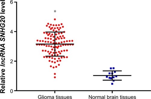 Figure 1 The lncRNA SNHG20 expression levels in glioma tissues are outstandingly higher than those in normal brain tissues.Note: *P<0.05 means vs normal brain tissues.