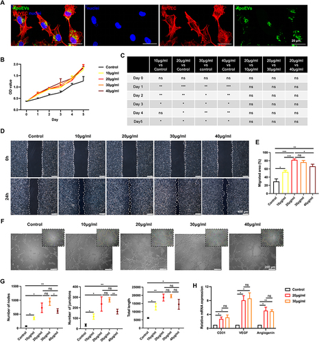 Figure 2 The effect of ApoEVs on the function of HUVECs in vitro. (A) Immunofluorescence staining of Dio-labeled ApoEVs (green) engulfed by HUVECs (red). Scale bar=20 μm. (B and C) CCK-8 analysis of the effect of different concentrations of ApoEVs on the proliferation of HUVECs. (D) Scratch analysis of the effect of different concentrations of ApoEVs on the migration of HUVECs. Scale bar=400 μm. (E) Statistic analysis of migrated area (n=3). (F) Tube formation analysis of the effect of different concentrations of ApoEVs on the angiogenesis of HUVECs. Scale bar=200 μm. (G) Statistic analysis of the number of nodes, number of junctions, and total length. (H) qRT-PCR analysis of the difference between 20 μg/mL and 30 μg/mL ApoEVs on the angiogenic differentiation of HUVECs. The significance was tested with an unpaired two-tailed Student’s t-test. (nsp>0.05, *p<0.05, **p<0.01, ***p<0.001).