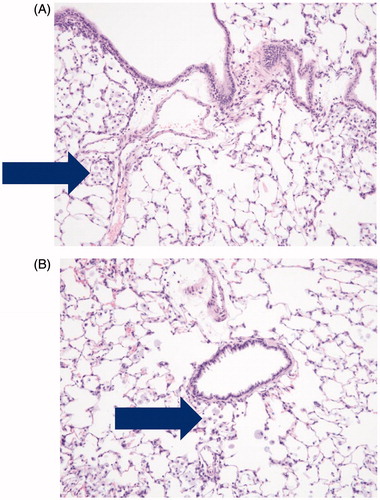 Figure 4. Photomicrographs of pulmonary alveolar macrophages (“foam cells”) in the lung of male rats after 90-days of inhalation exposure to high dose of (A) vehicle control or (B) Formulation 2 (20 × magnification).